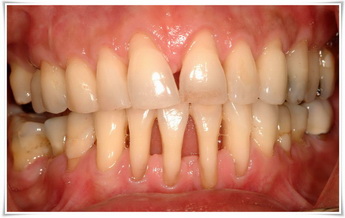 teeth