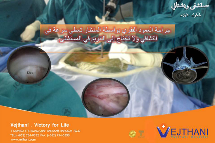 Laparoscopic-spinal-surgery