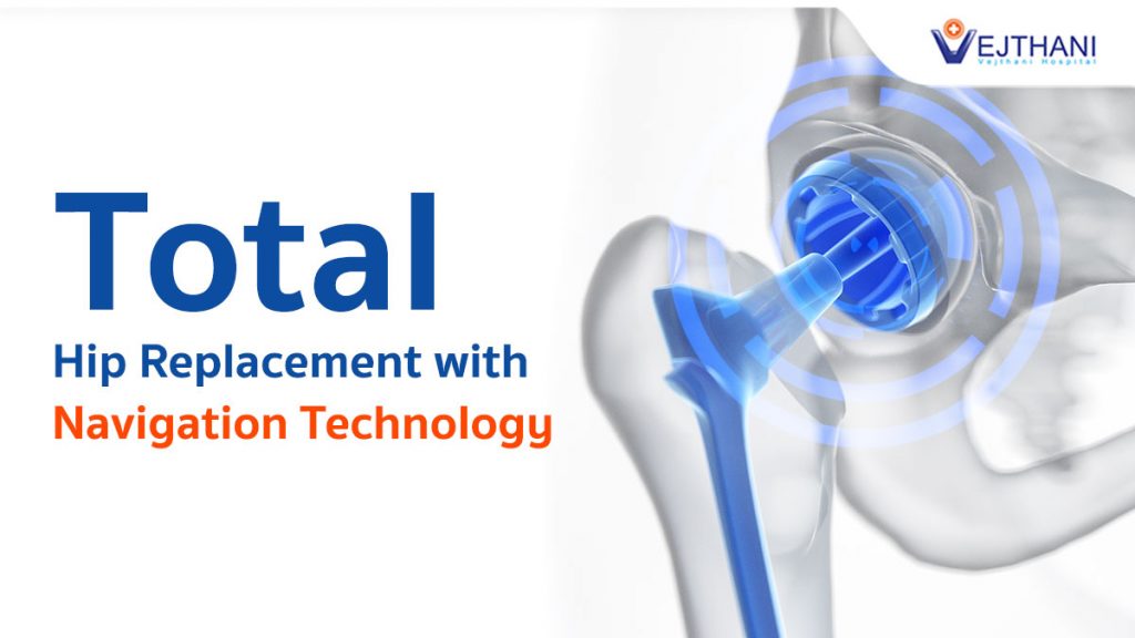 Total Hip Replacement with Navigation Technology Vejthani Hospital