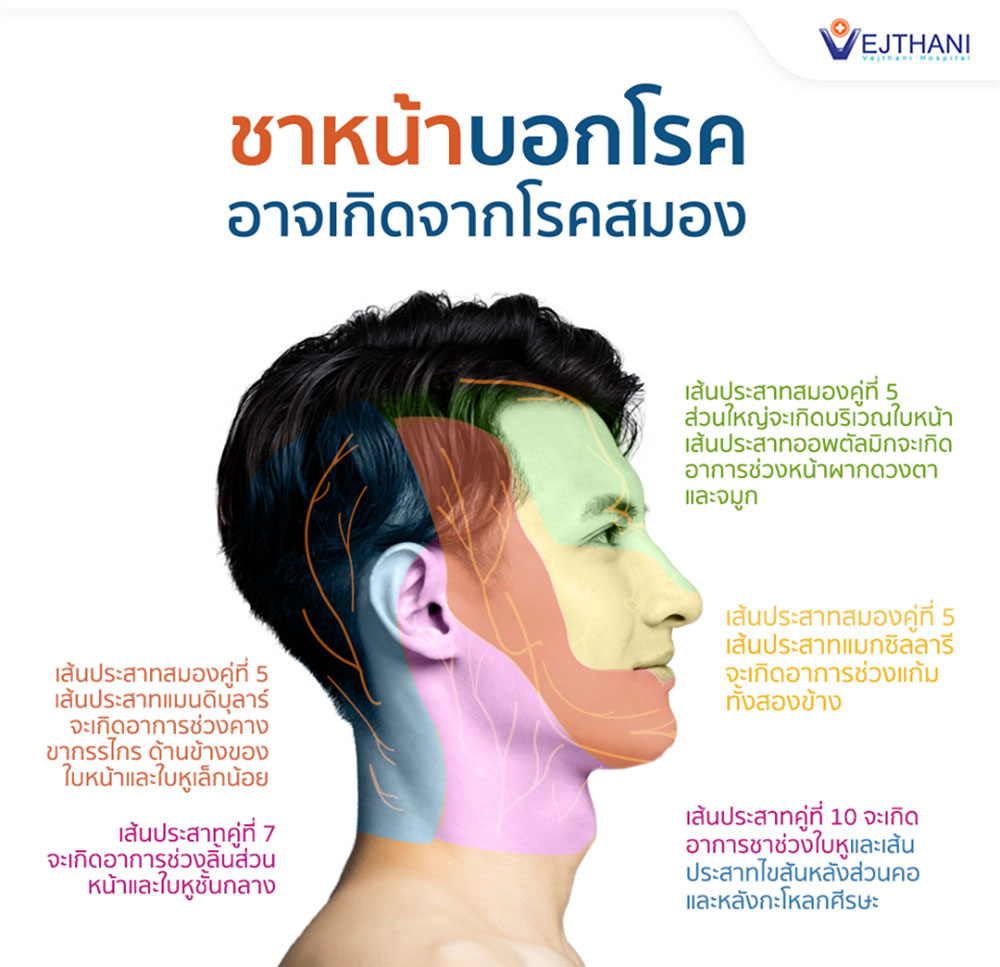 อาการชาที่ใบหน้าสามารถเกิดได้จากหลายสาเหตุ ได้แก่ การบาดเจ็บจากอุบัติเหตุ อาการชาที่ใบหน้าสามารถเกิดได้จากหลายสาเหตุ ได้แก่ การบาดเจ็บจากอุบัติเหตุ
