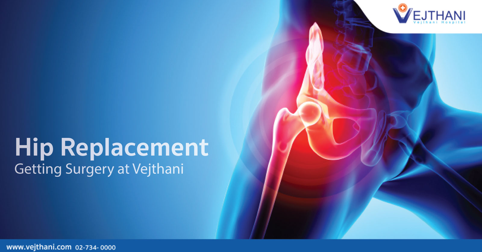 hip replacement medical tourism