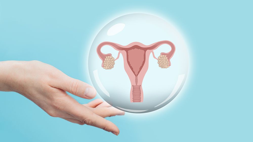 OVARIAN CYST