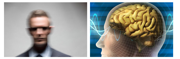โรคลมชัก (epilepsy) เรื่องใหญ่!! แต่แก้ไขได้ - โรงพยาบาลเวชธานี โรคลมชัก (Epilepsy) เรื่องใหญ่!! แต่แก้ไขได้ - โรงพยาบาลเวชธานี