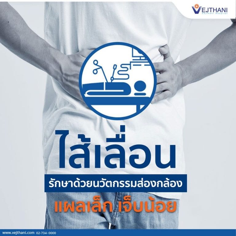 รักษาโรคไส้เลื่อนโดยการส่องกล้อง วิธีที่ไม่ต้องพักฟื้นนาน