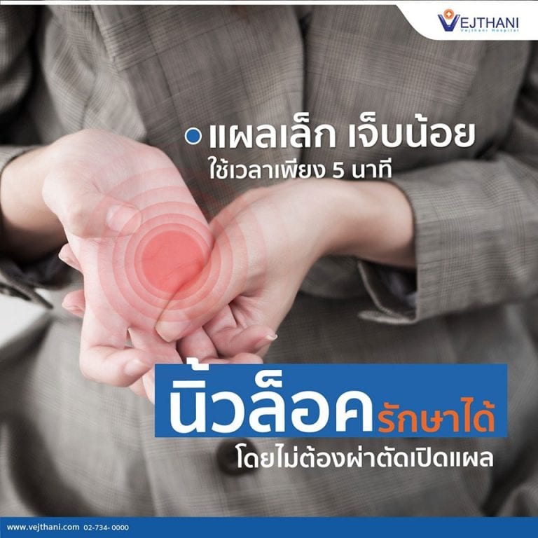 รักษานิ้วล็อกให้หายไวได้ ในเวลาเพียง 5 นาที