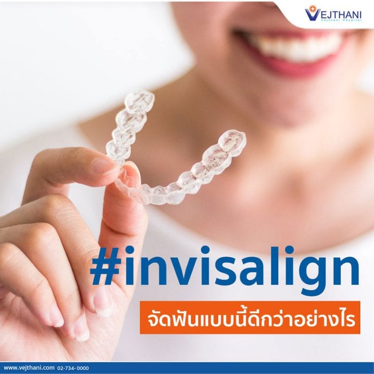 จัดฟันแบบ Invisalign