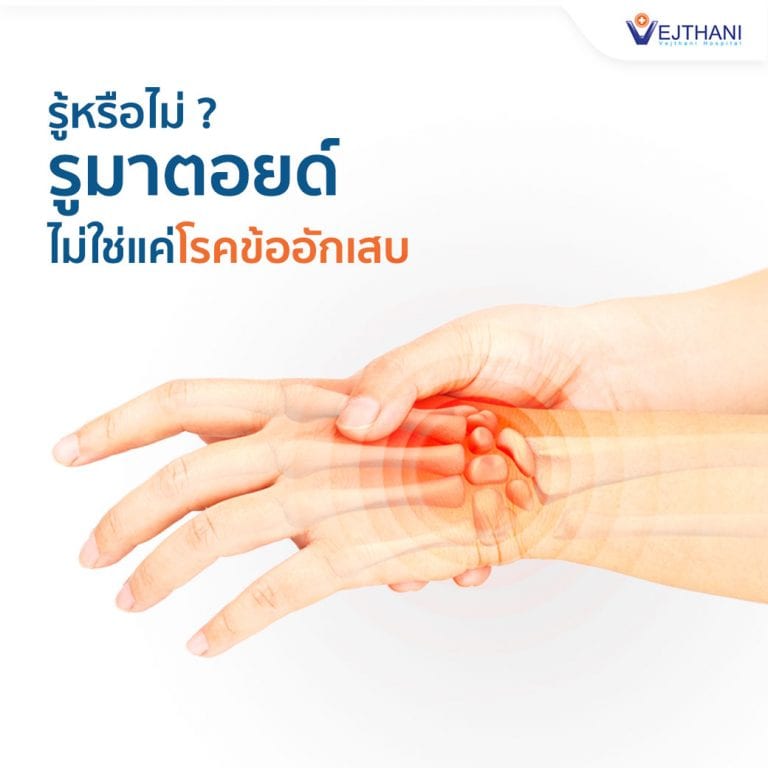 ความแตกต่างระหว่างโรครูมาตอยด์กับโรคข้ออักเสบ