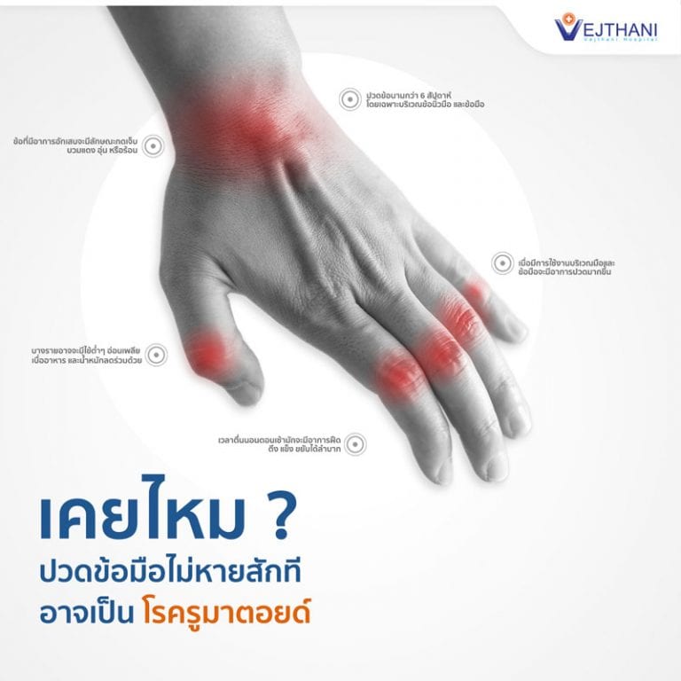 โรครูมาตอยด์