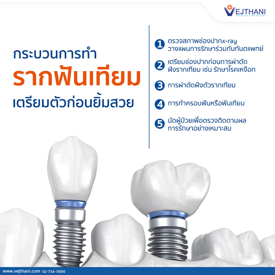 ทำรากเทียม