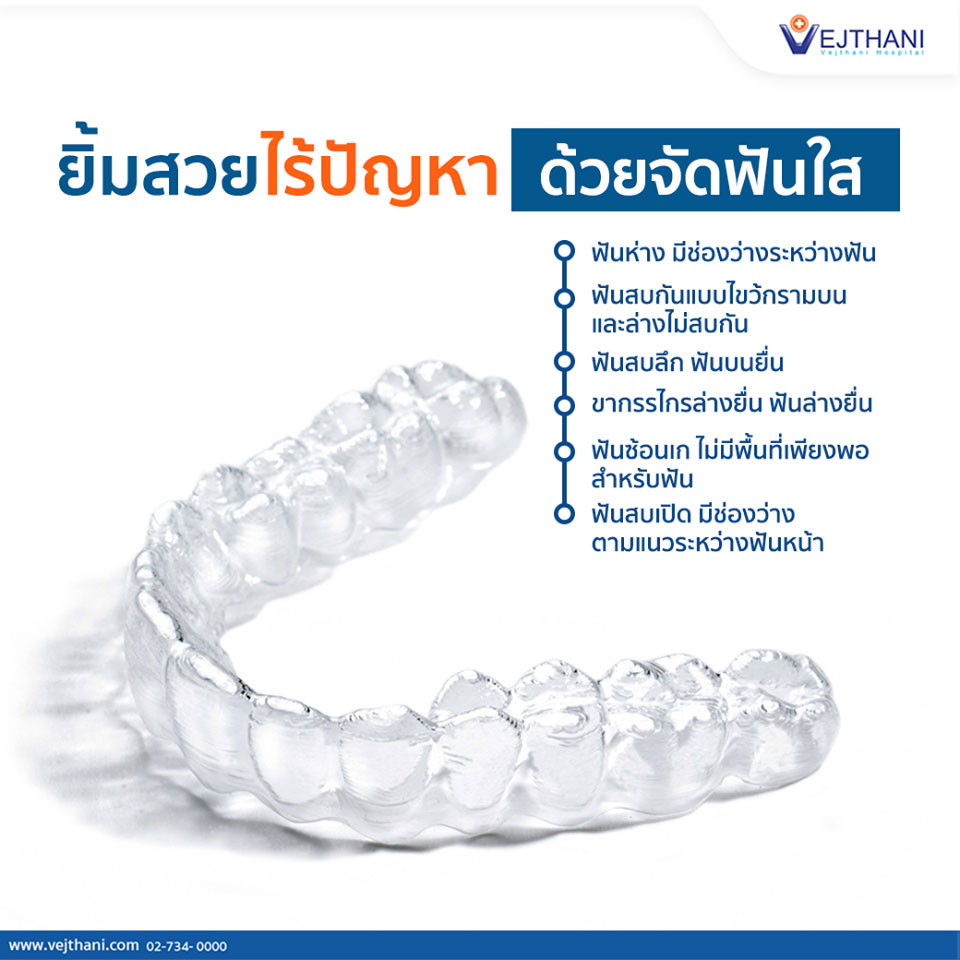 ยิ้มสวยไร้ปัญหา ด้วย จัดฟันใส - Vejthani Hospital ยิ้มสวยไร้ปัญหา ด้วย จัดฟันใส - Vejthani Hospital