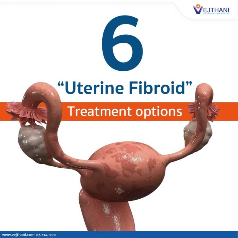 Fibroid