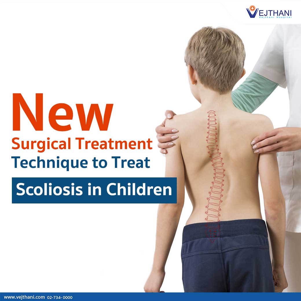 New Surgical Treatment Technique to Treat Scoliosis in Children