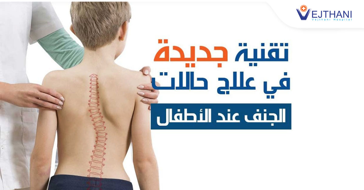 تقنية جديدة في علاج حالات الجنف عند الاطفال