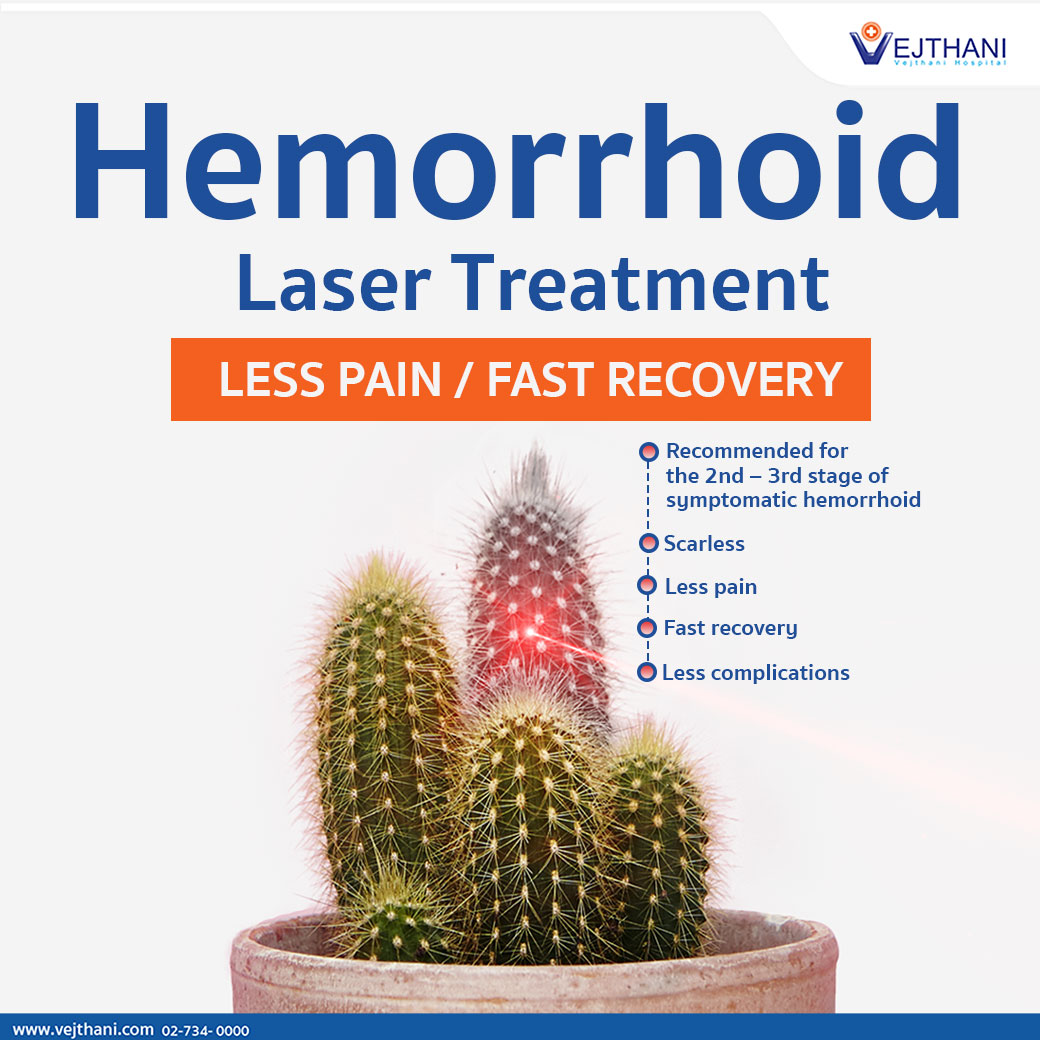 Hemorrhoids laser treatment