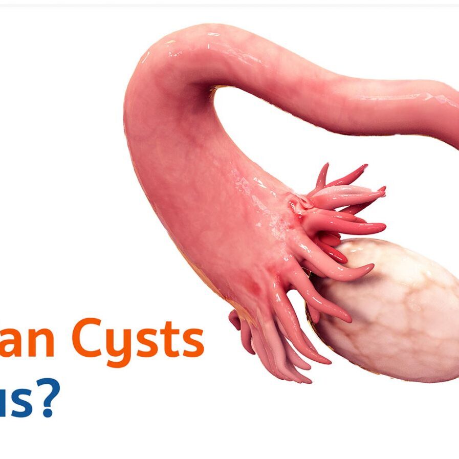 Ovarian Cyst - Vejthani Hospital Ovarian Cyst - Vejthani Hospital