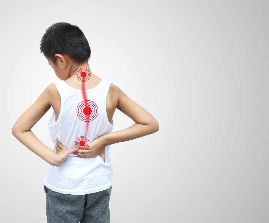 Treating-Scoliosis-in-Children