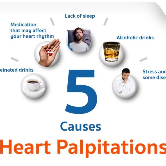 5 Causes of Heart Palpitations