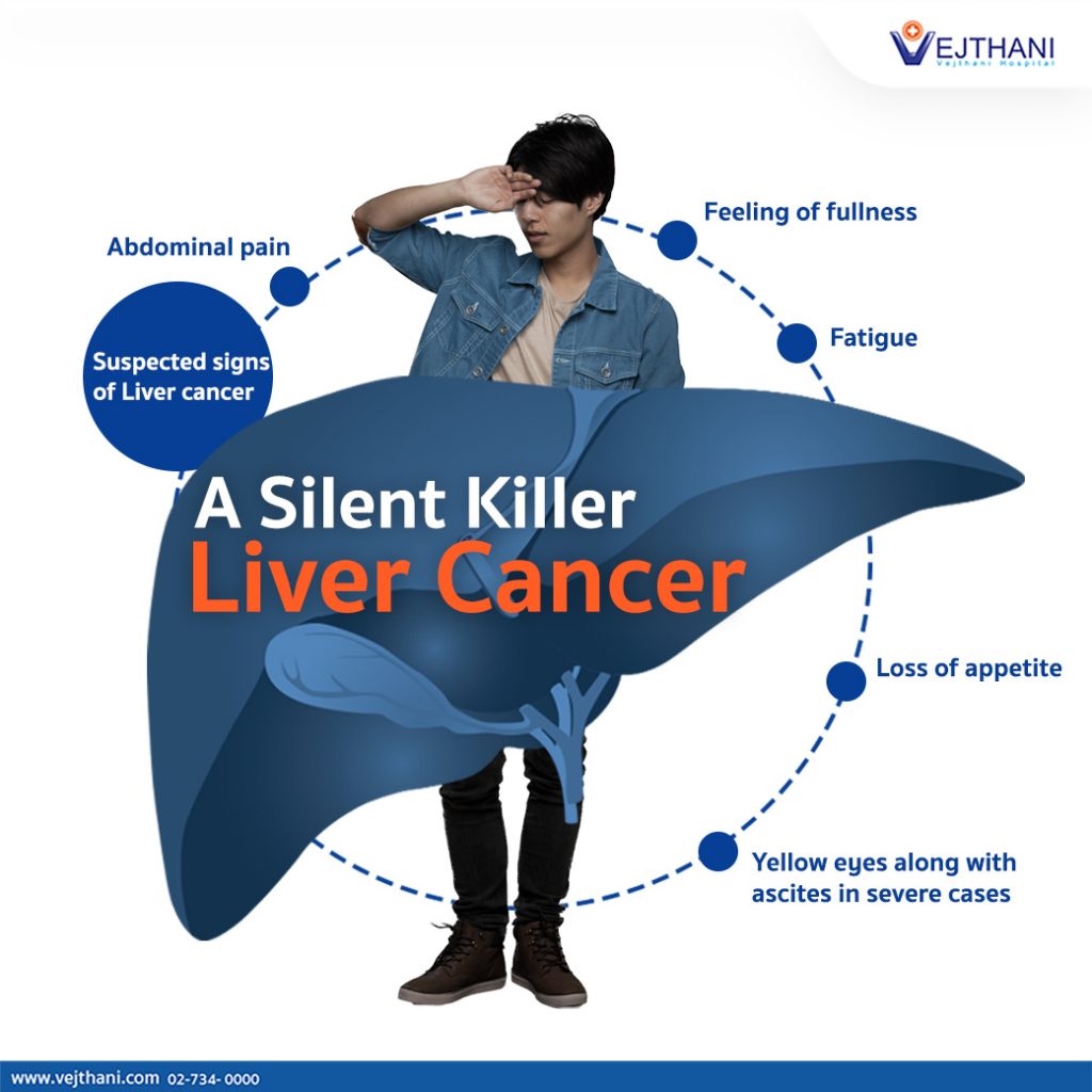 liver cancer symptoms