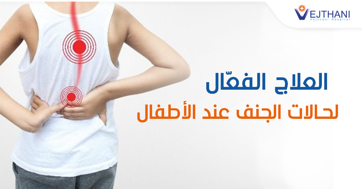 العلاج الفعّال لحالات الجنف عند الأطفال