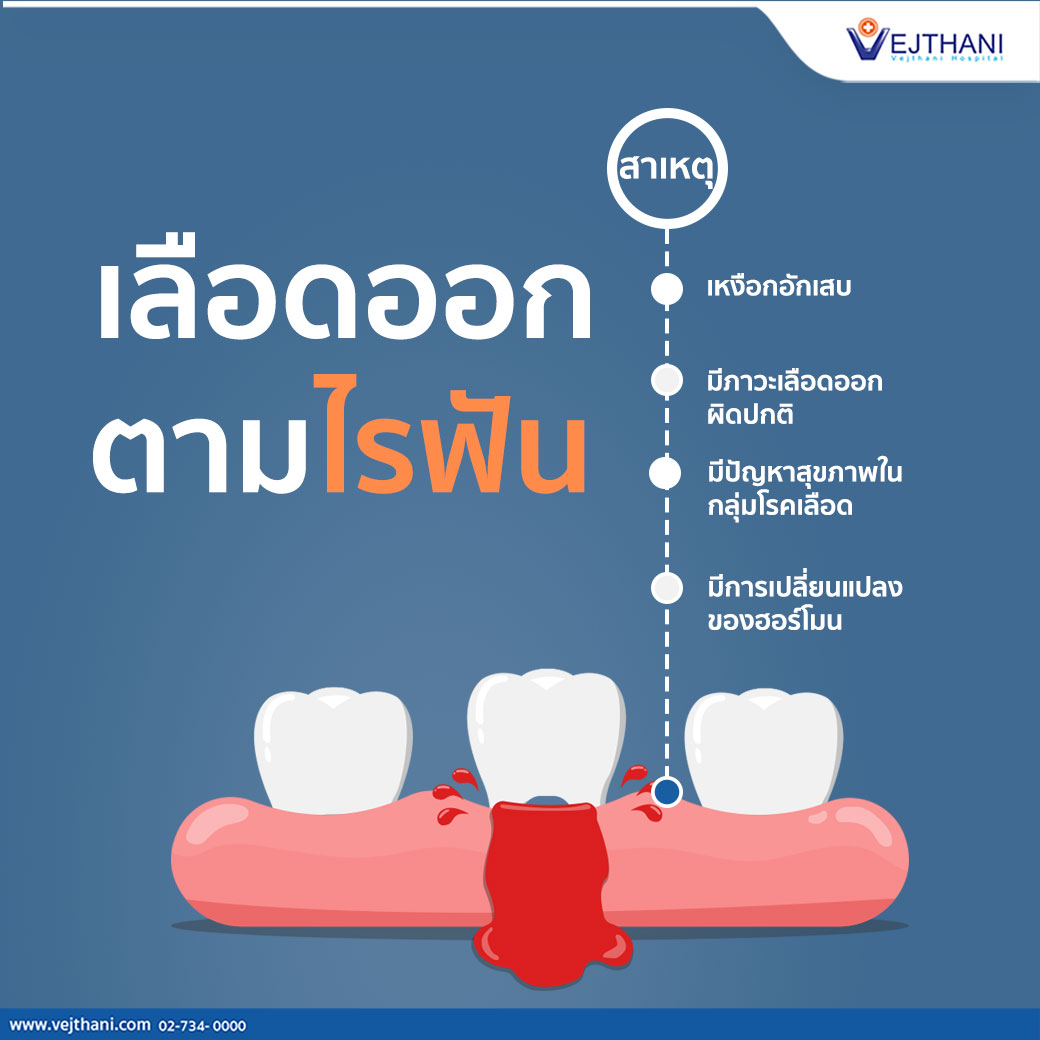 เลือดออกตามไรฟัน บ่งชี้โรคอะไรได้บ้าง - โรงพยาบาลเวชธานี เลือดออกตามไรฟัน บ่งชี้โรคอะไรได้บ้าง - โรงพยาบาลเวชธานี