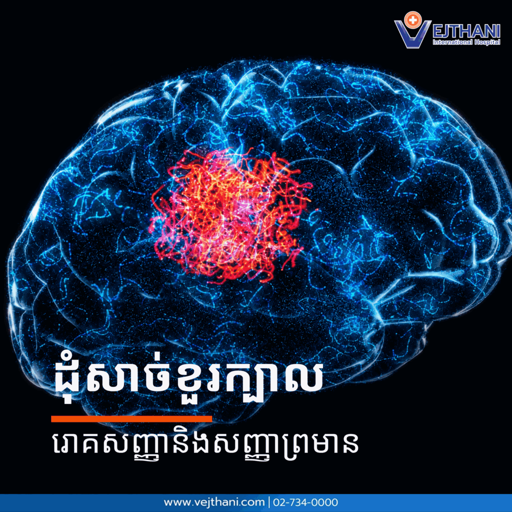 ដុំសាច់ក្នុងខួរក្បាល រោគសញ្ញា និងសញ្ញាព្រមាន
