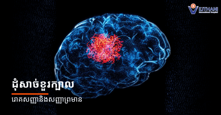 ដុំសាច់ក្នុងខួរក្បាល រោគសញ្ញា និងសញ្ញាព្រមាន