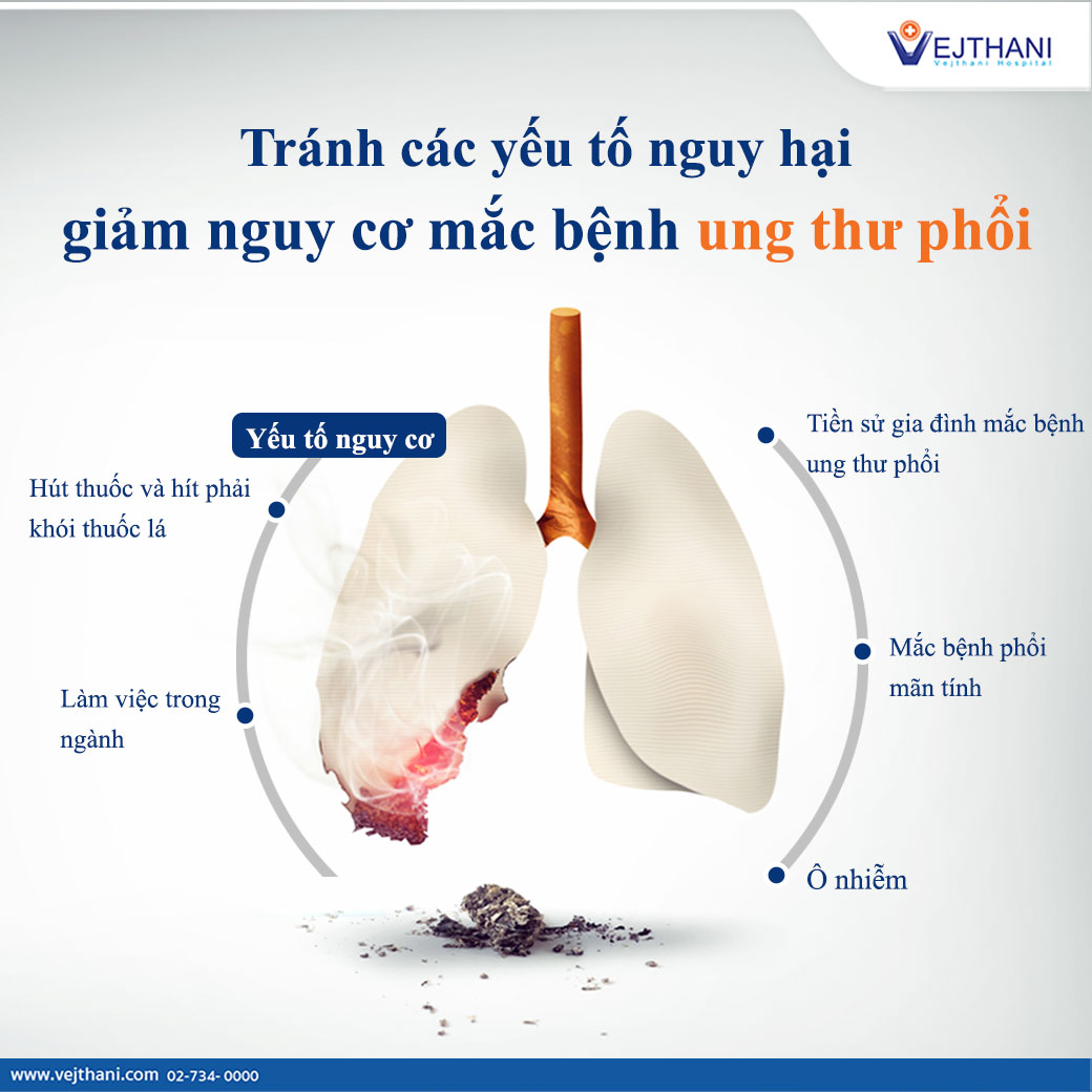 Mô hình các phân thùy của phổi #48 Mô hình các phân thùy của phổi