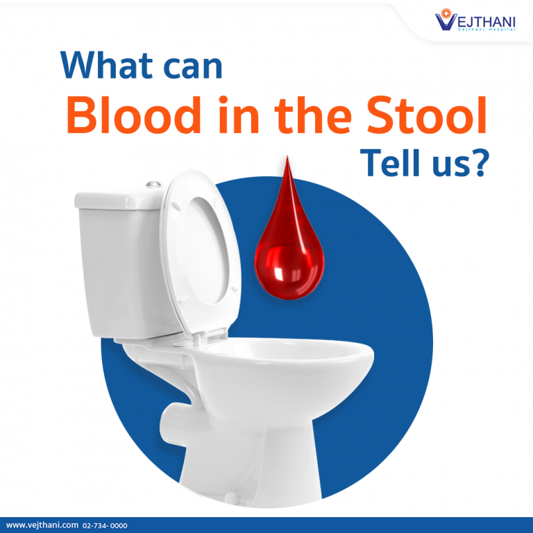 ิblood in stool