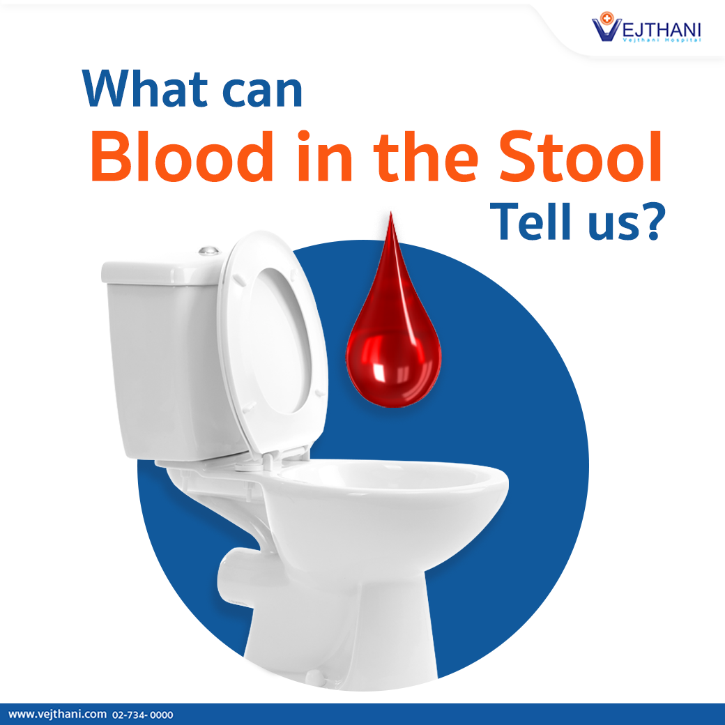Best Blood On Stool Hemorrhoid of the decade Learn more here | stoolz