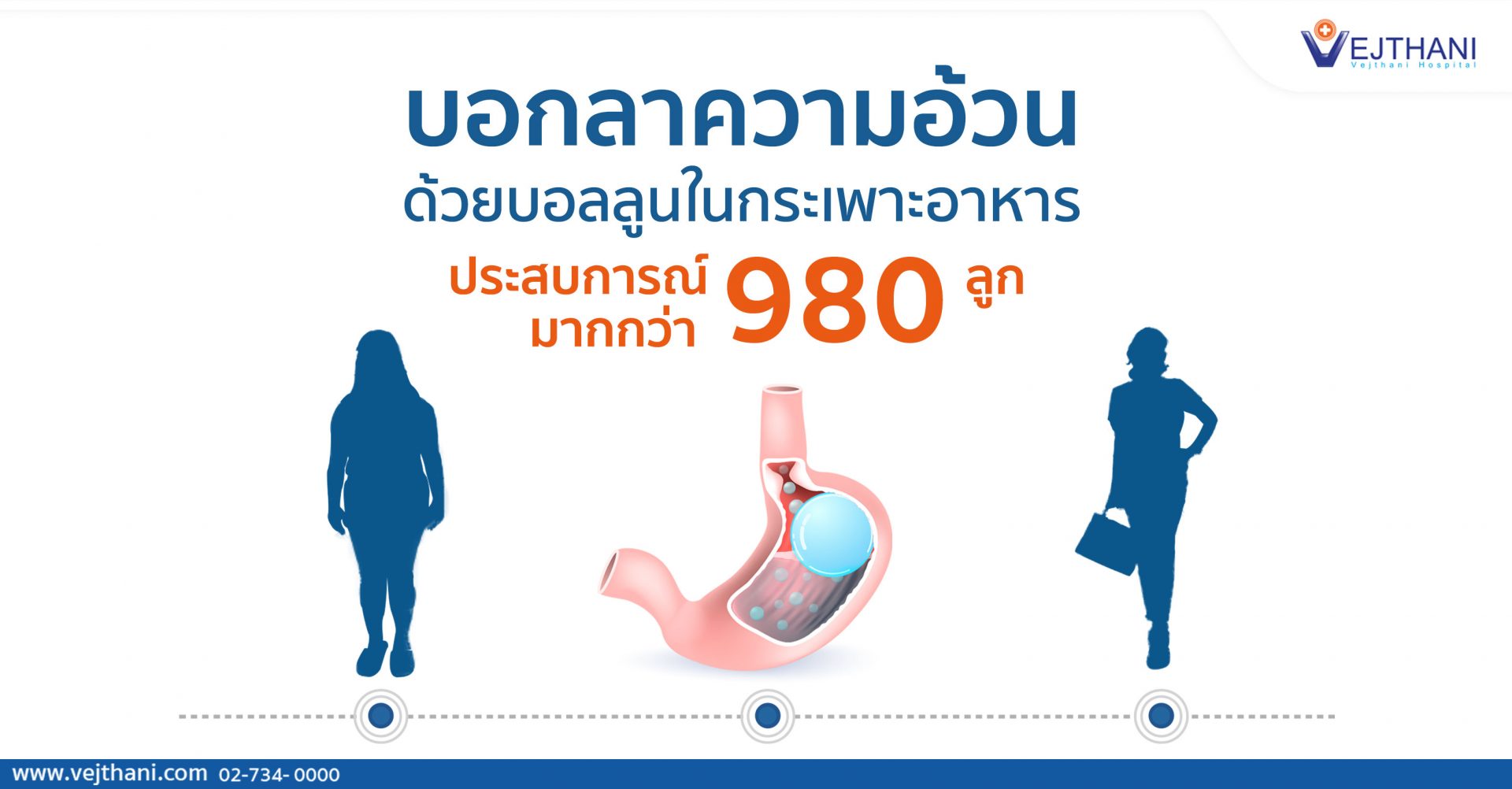 บอลลูนกระเพาะอาหาร