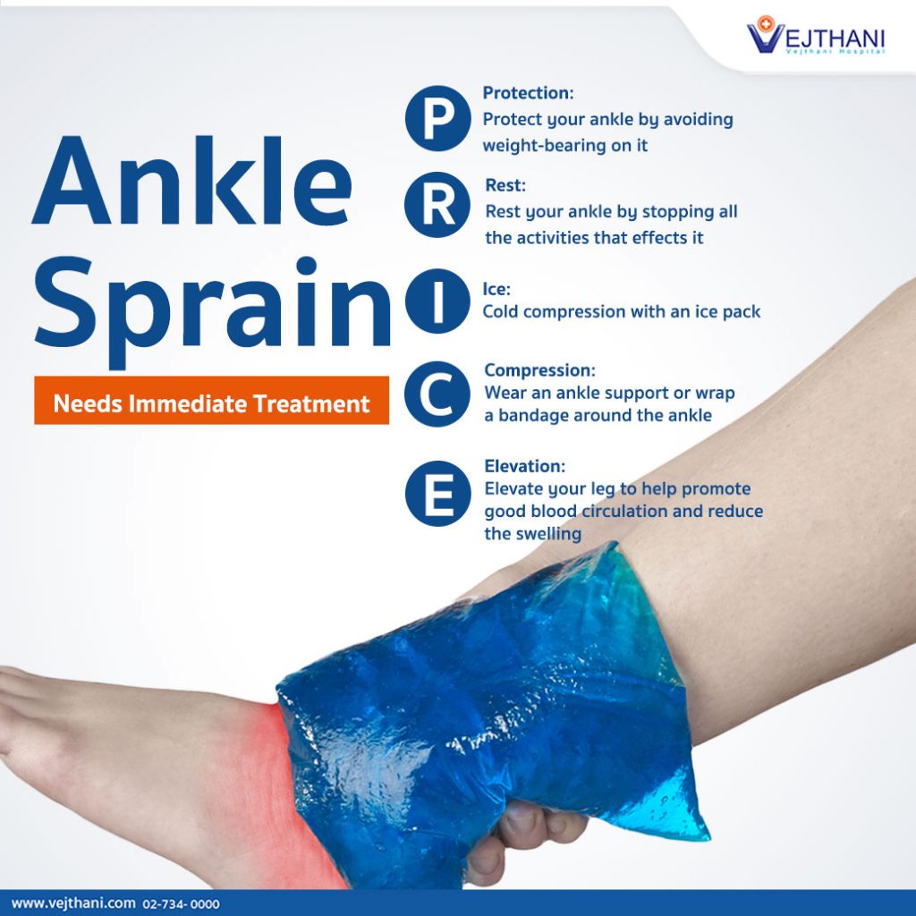 Ankle Sprains: Causes, Symptoms & Treatment