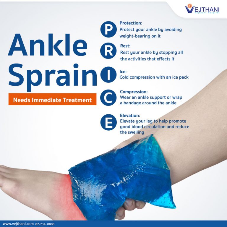 Ankle sprain