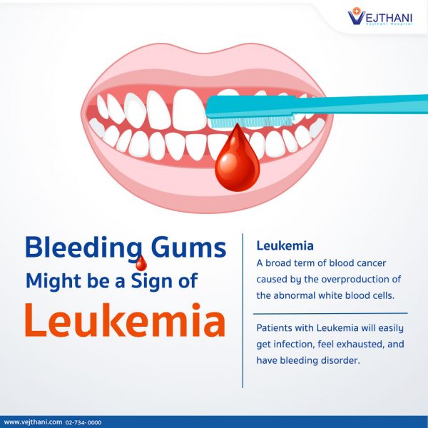 Snapshot of Leukemia Causing Gum Inflammation