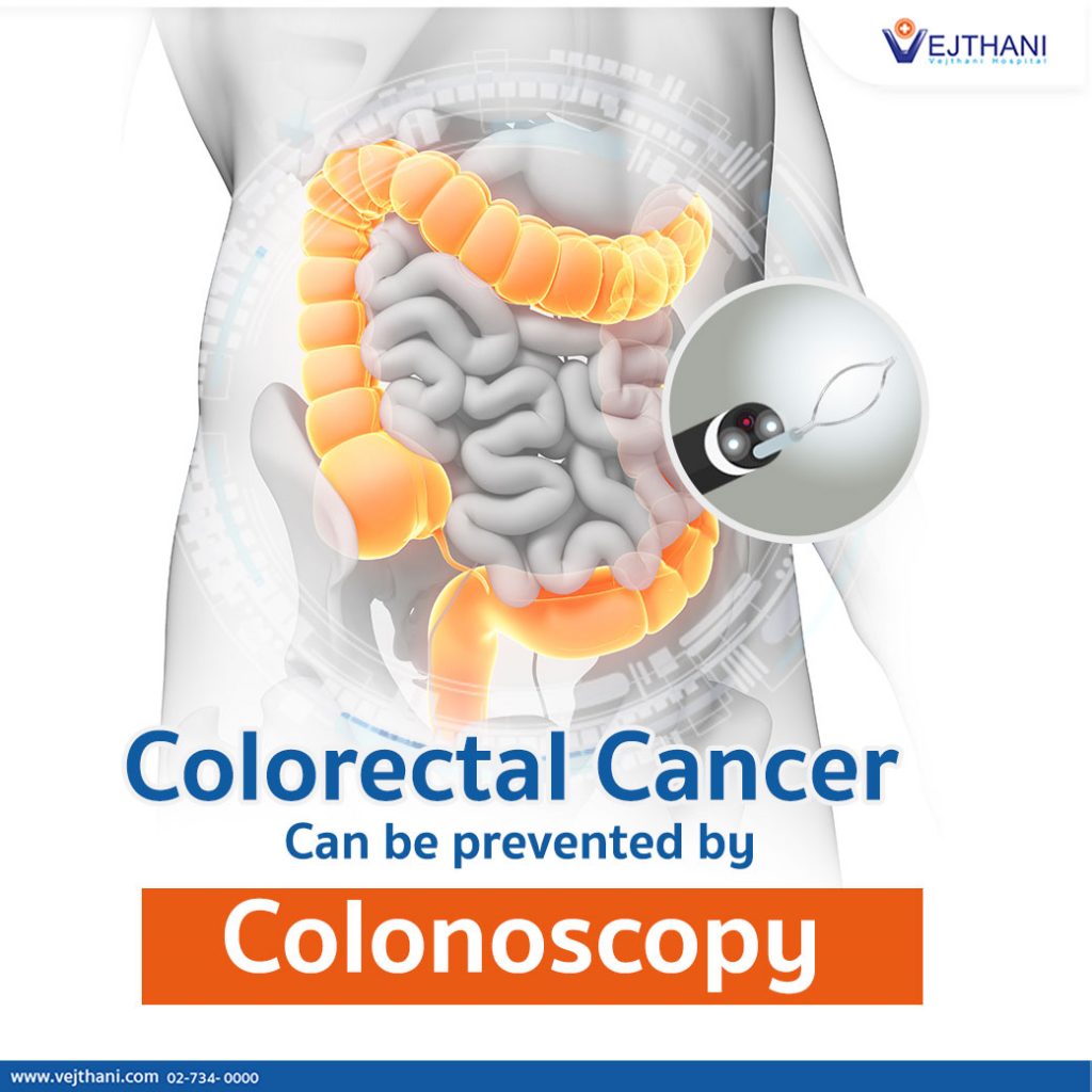 Colonoscopy