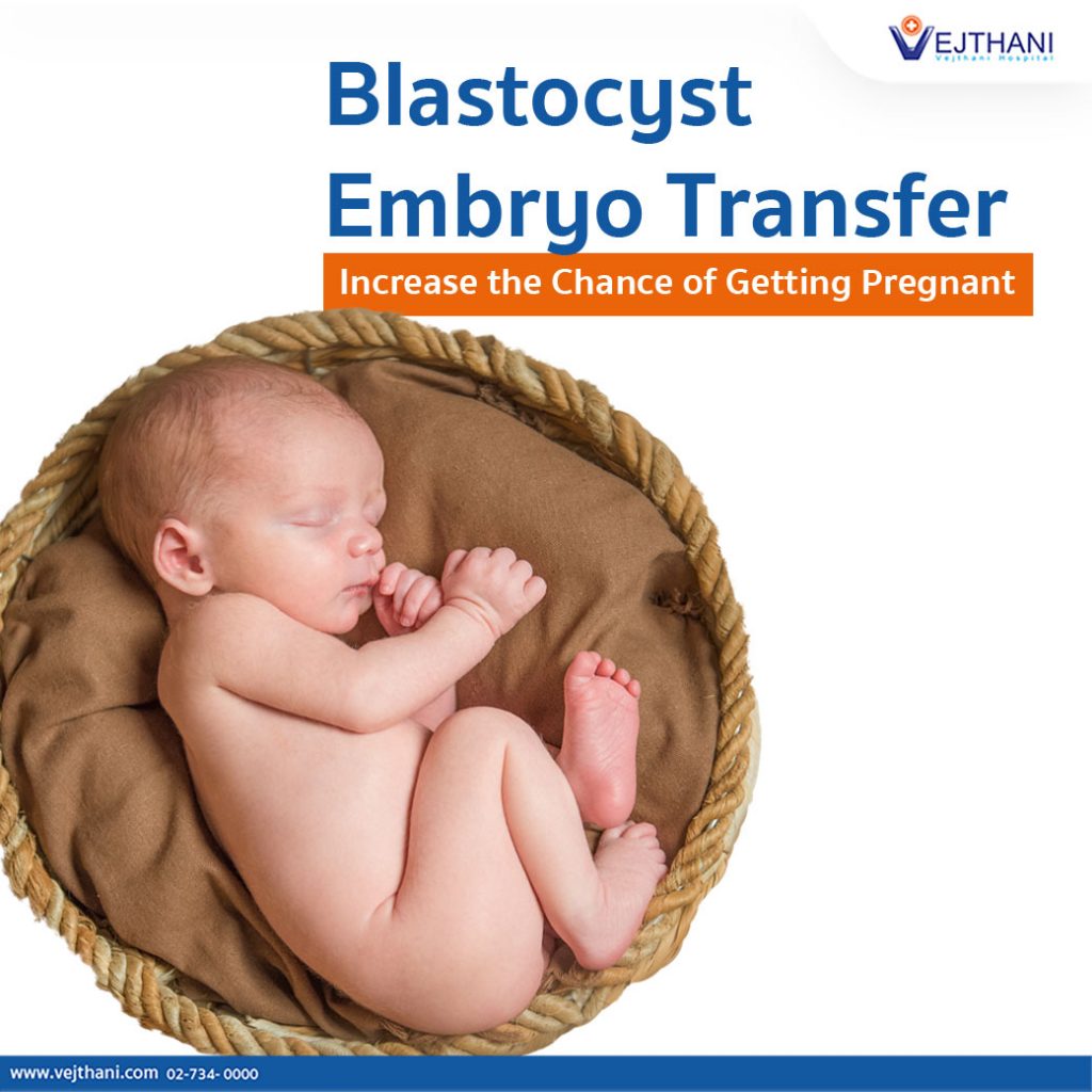 Embryo transfer