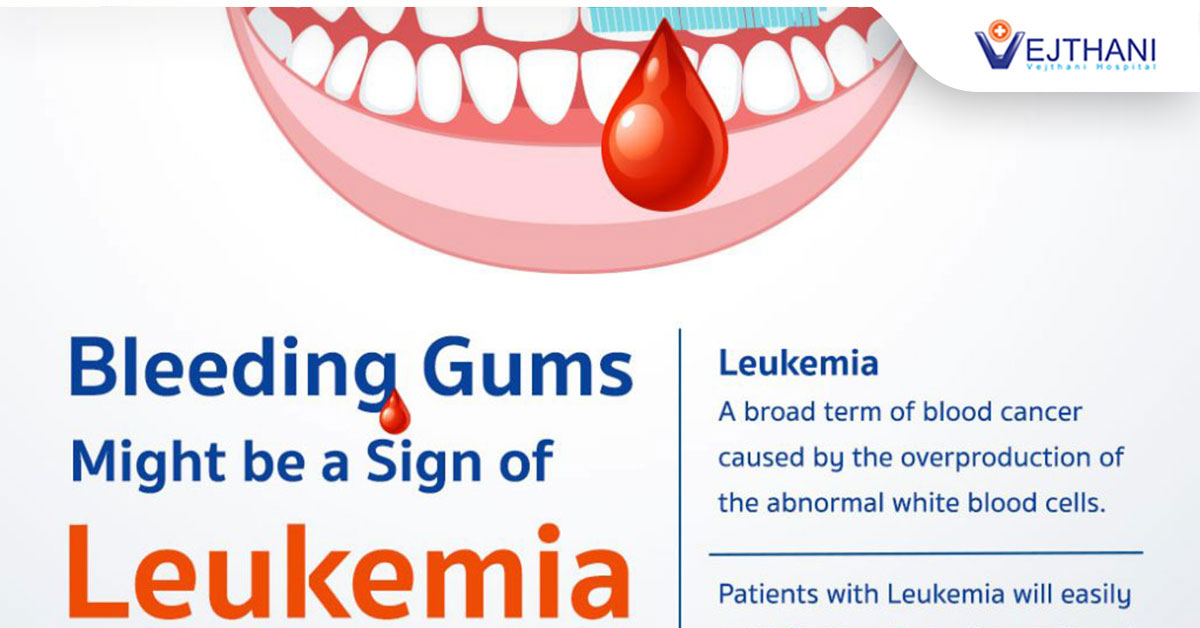 Bleeding Gums Might be a Sign of Leukemia