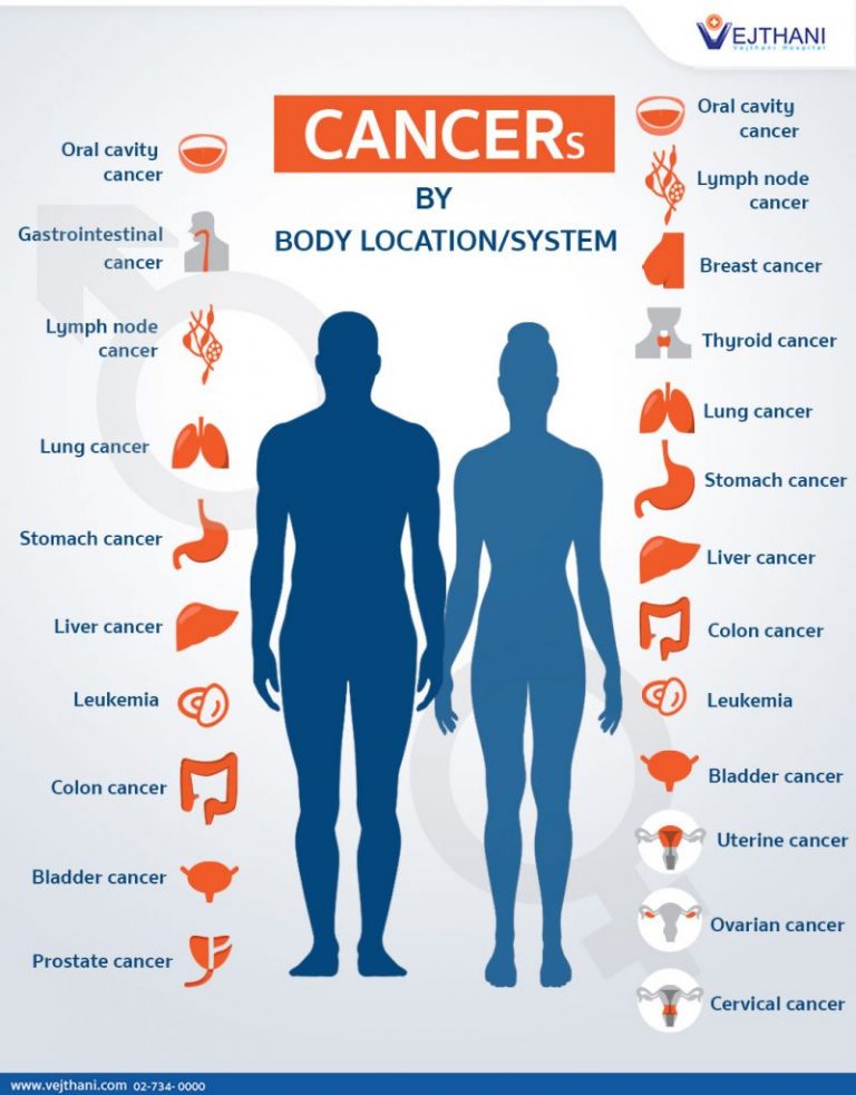 The most common cancers in men