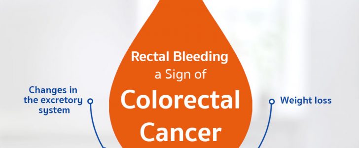 Colorectal cancer