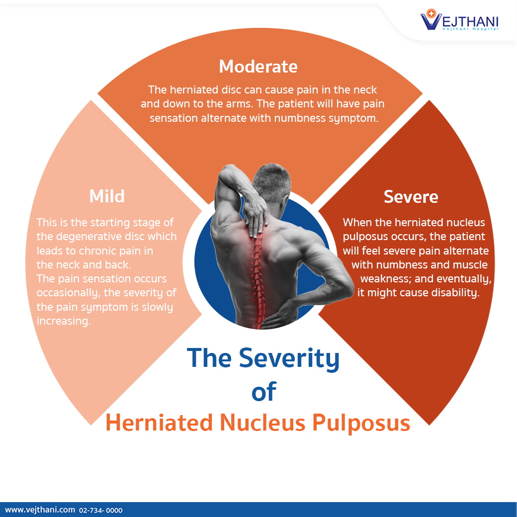 The Severity of Herniated Nucleus Pulposus Vejthani