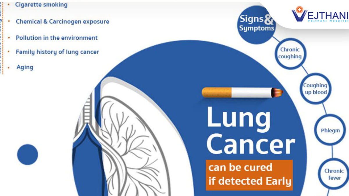 cigarette smoking causes lung cancer Risk Factors and Prevention PET Imaging Know the Risk Factors