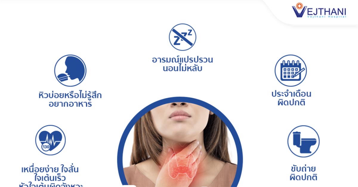 ไทรอยด์