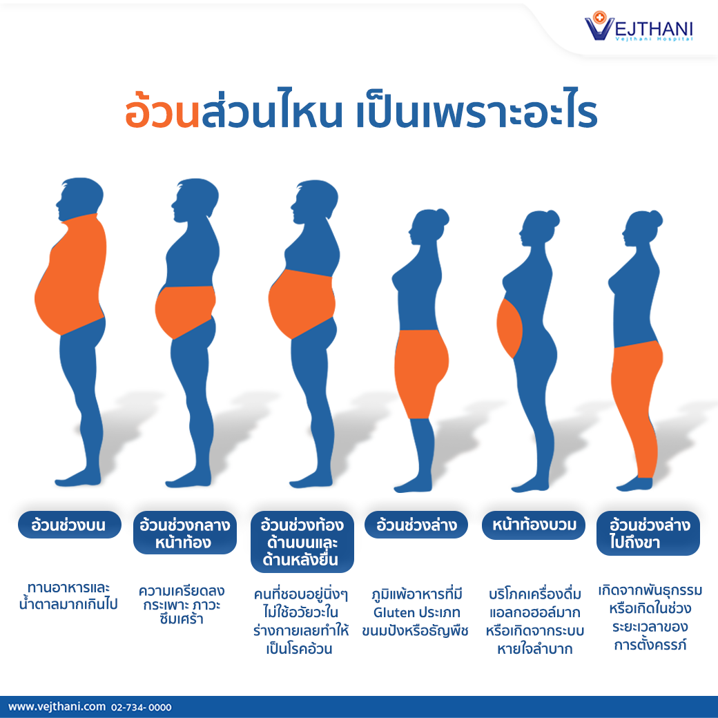 อ้วนส่วนไหน เป็นเพราะอะไร ? - โรงพยาบาลเวชธานี อ้วนส่วนไหน เป็นเพราะอะไร ? - โรงพยาบาลเวชธานี