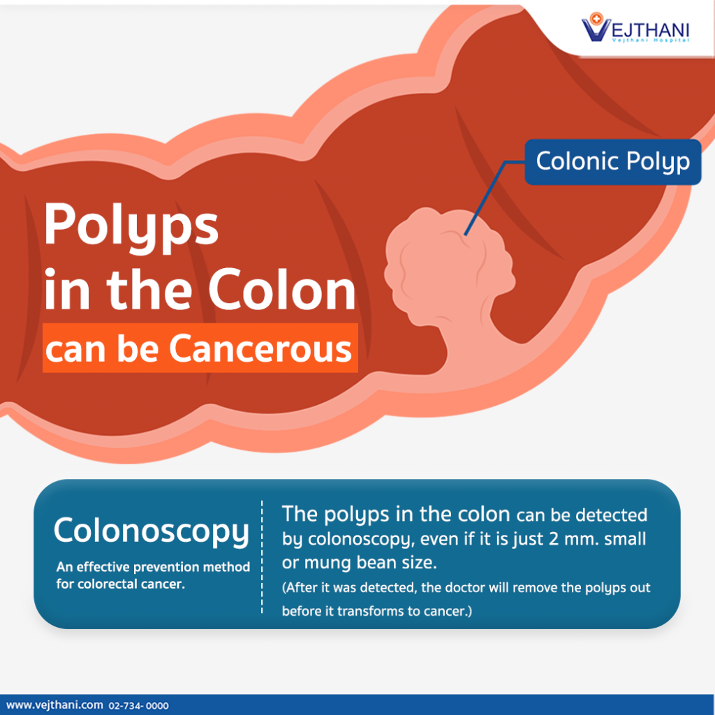 Polyps