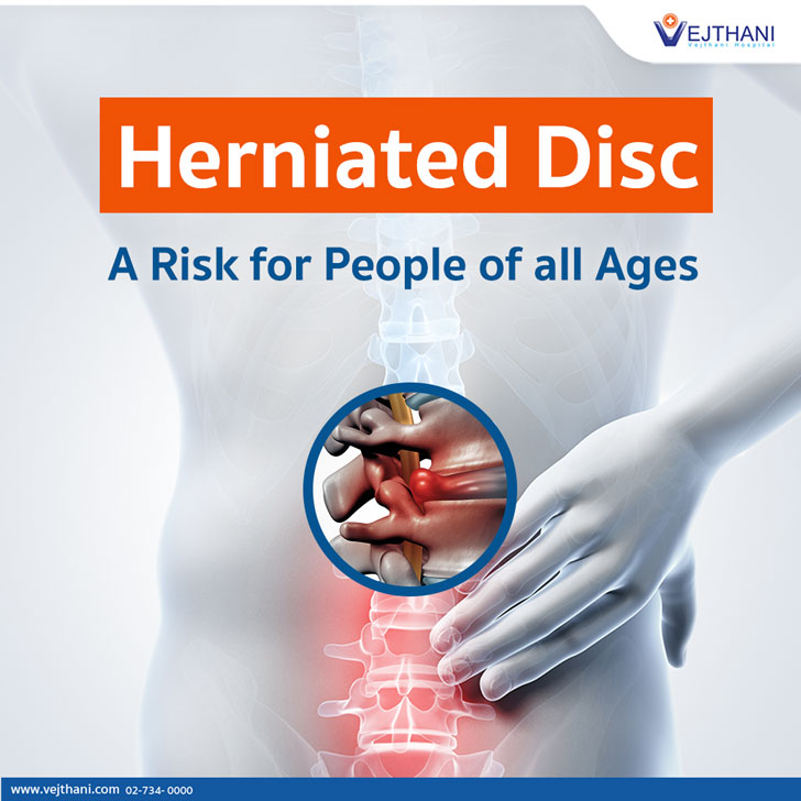 Herniated Disc could be a risk for People of all Ages