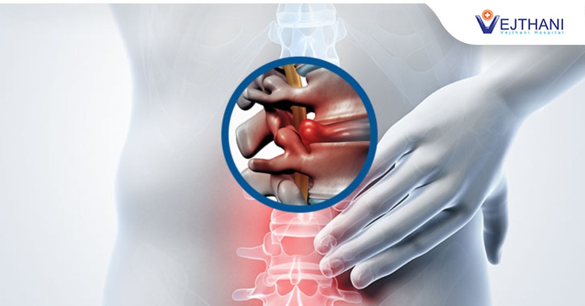 Herniated Disc could be a risk for People of all Ages
