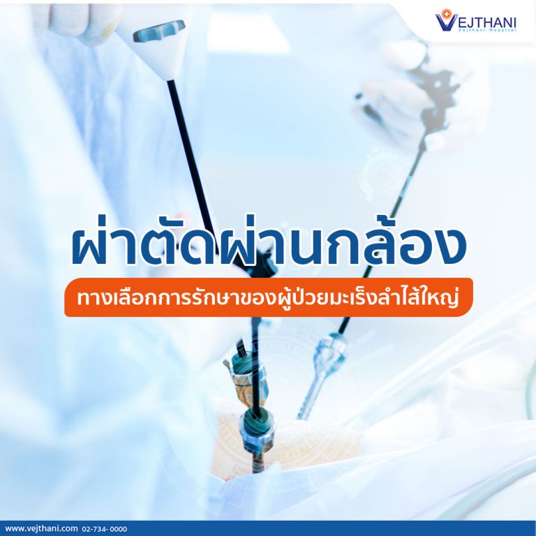 Endoscopic-surgery