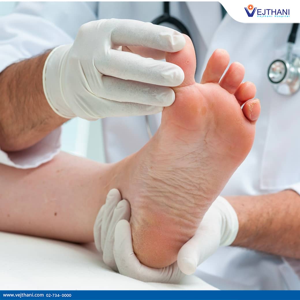 diabetic foot