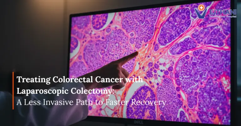 Colorectal cancer diagnosis – doctor pointing at tissue image on screen, showing laparoscopic colectomy treatment at Vejthani International Hospital.