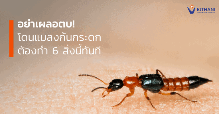 แมลงก้นกระดก