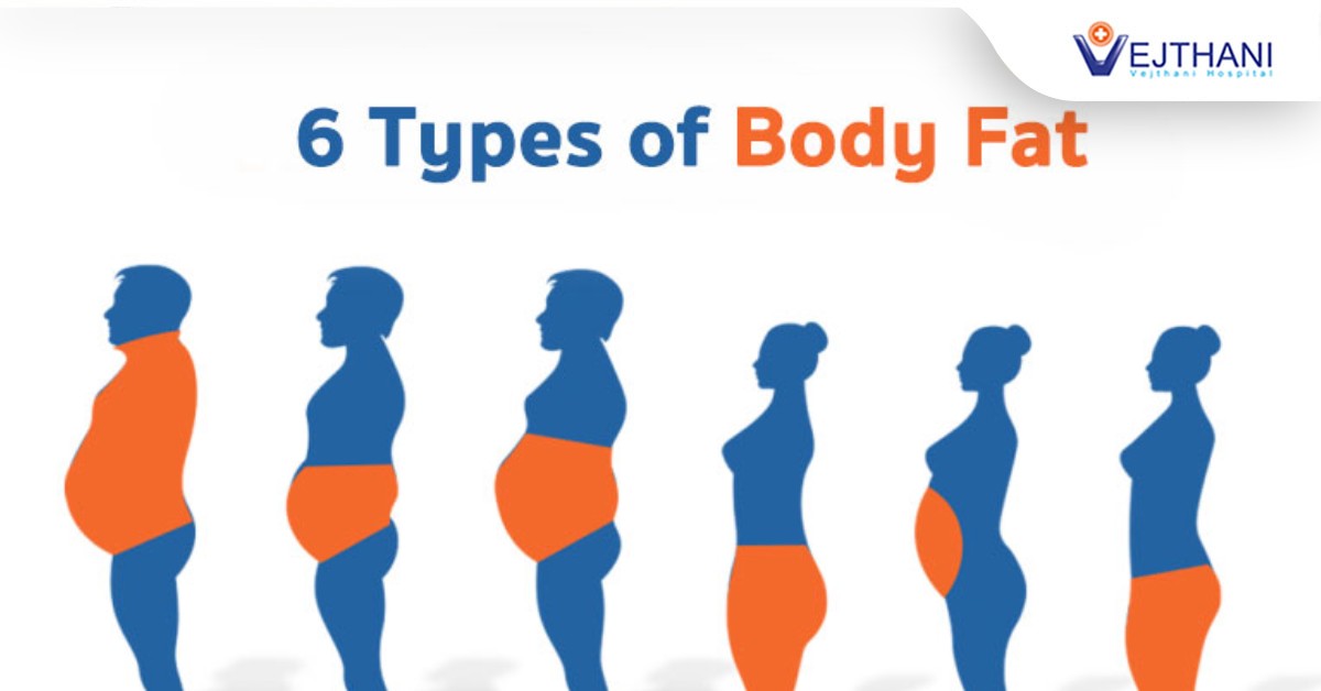Gaining weight on upper body hotsell